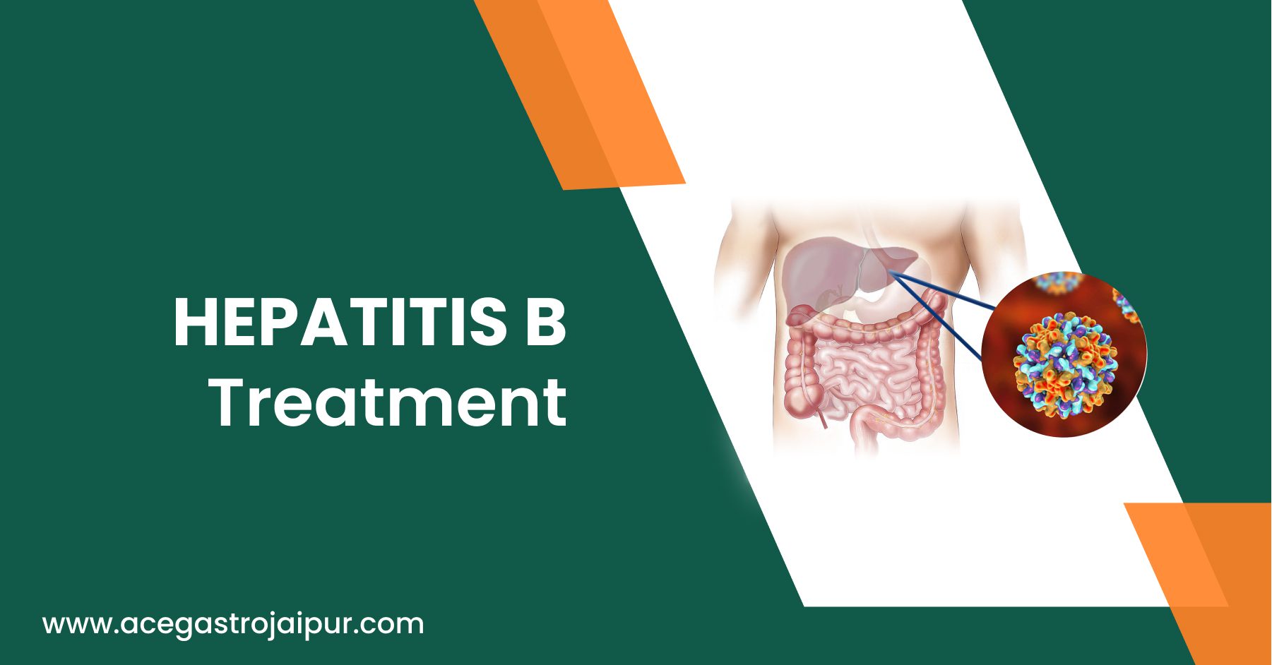 Hepatitis B Treatment in Jaipur