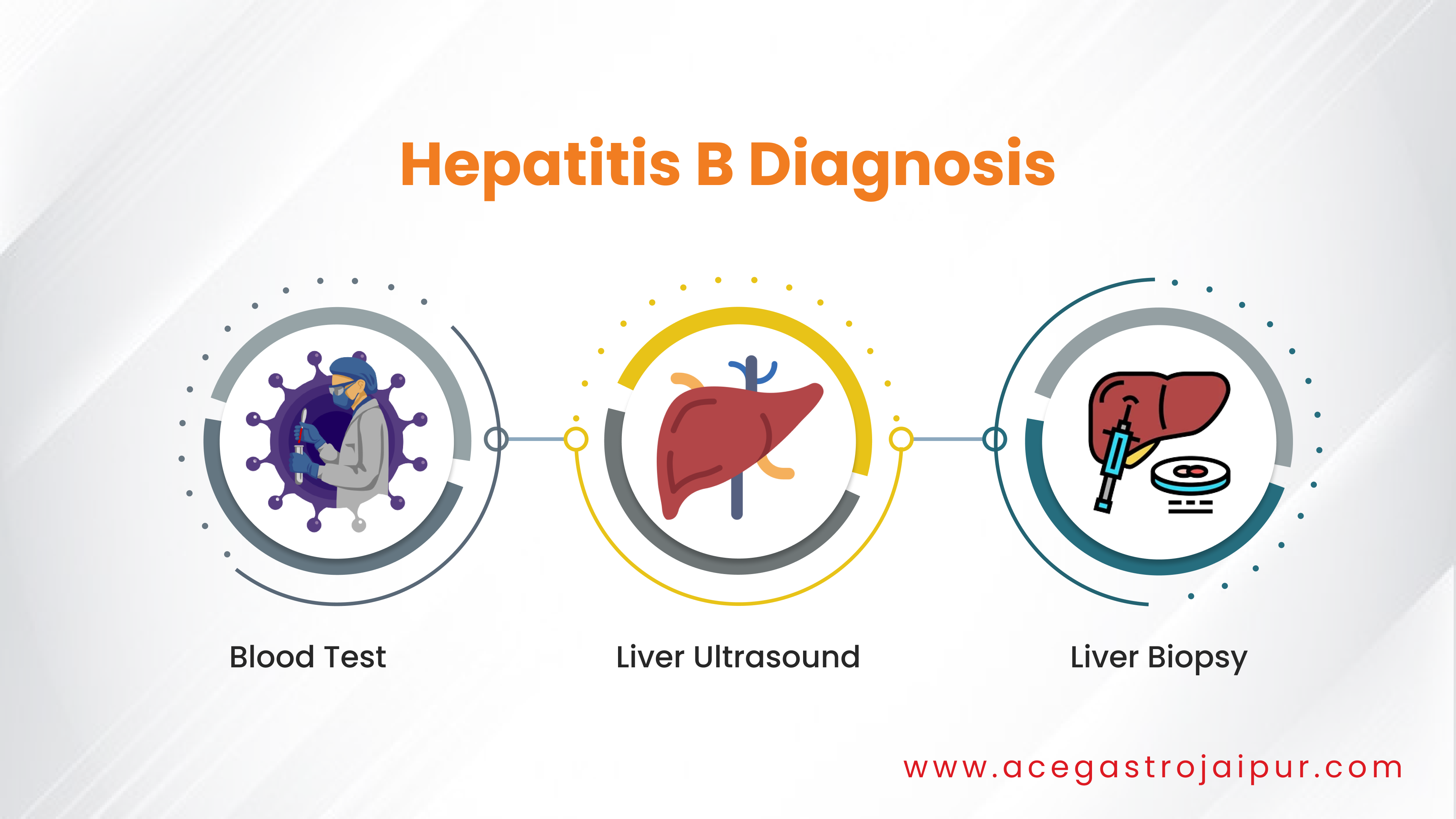 Hepatitis B Treatment in Jaipur
