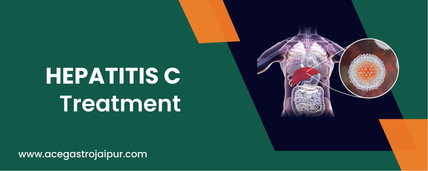 Hepatitis C Treatment in Jaipur
