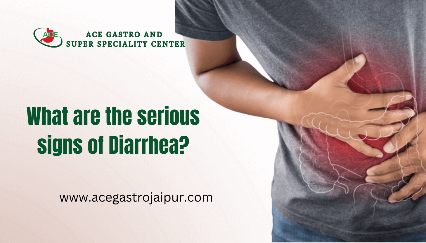 What are serious signs of Diarrhea?