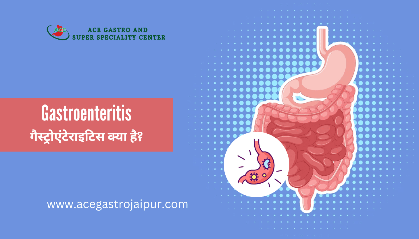 Gastroenteritis: गैस्ट्रोएंटेराइटिस क्या है?