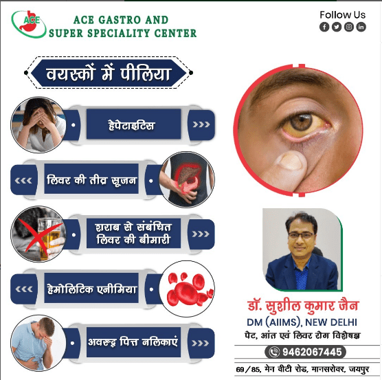वयस्कों में पीलिया होने के कुछ कारण हैं-