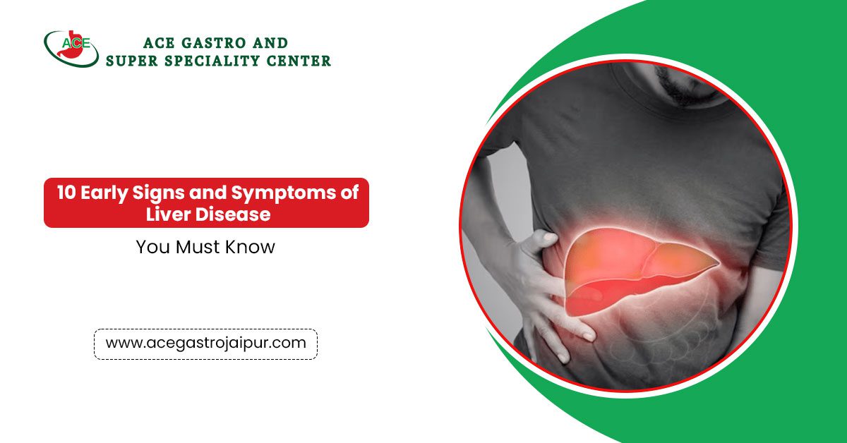10 Early Signs and Symptoms of Liver Disease – You Must Know