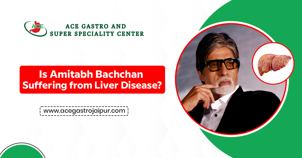 Is Amitabh Bachchan Suffering from Liver Disease?