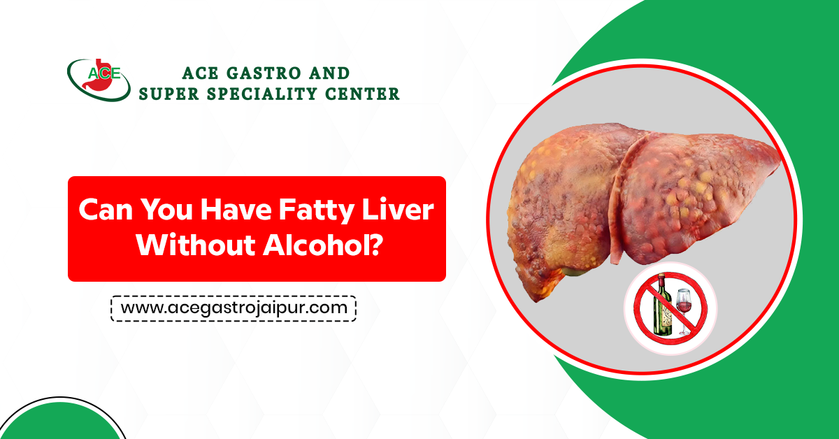 Can You Have Fatty Liver Without Alcohol?