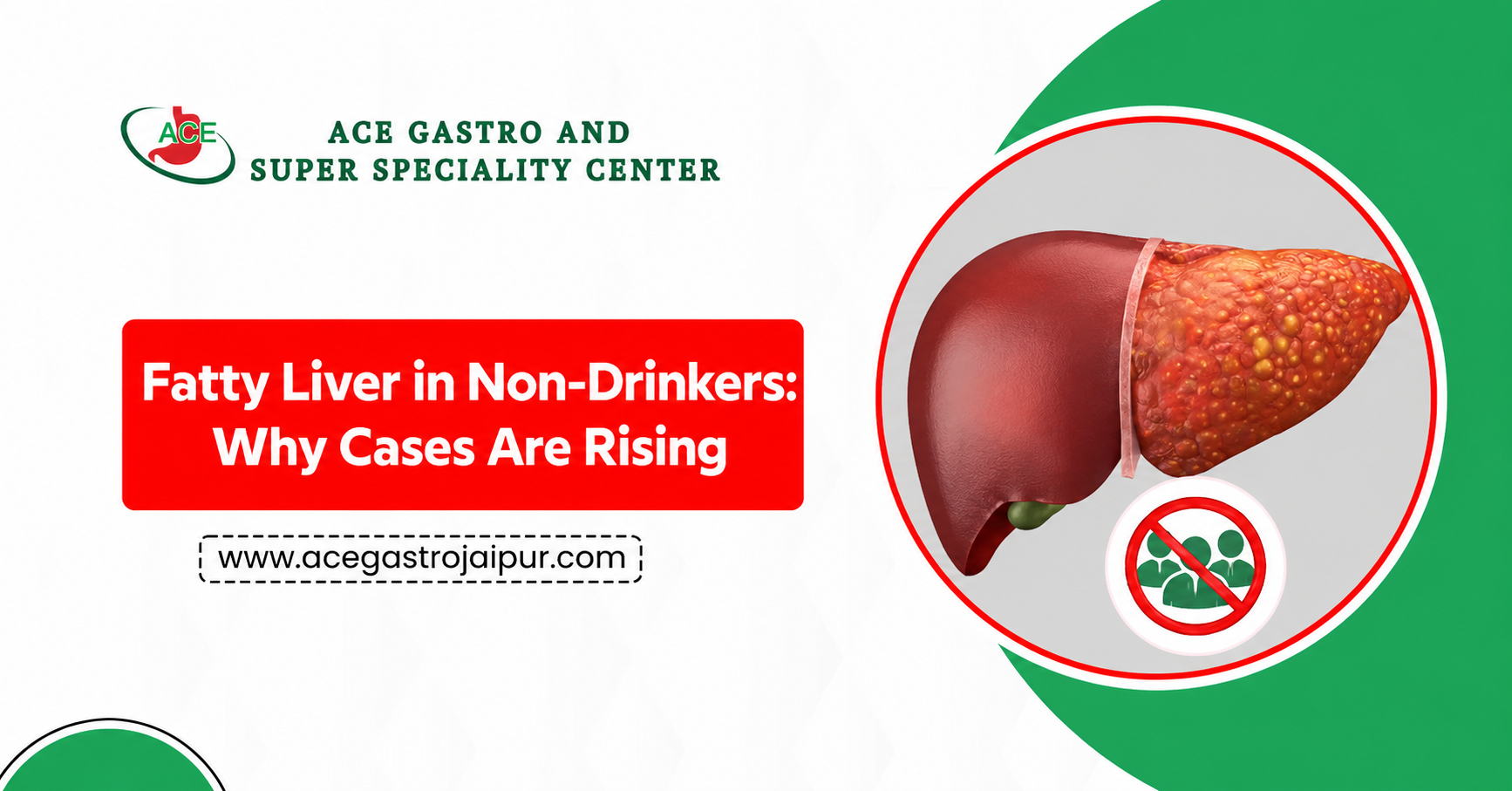 Fatty Liver in Non-Drinkers: Why Cases Are Rising