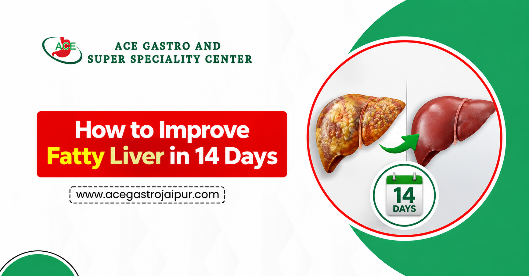 How to Improve Fatty Liver in 14 Days